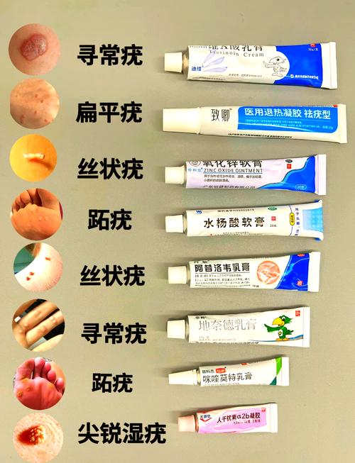治疗尖锐湿疣的药膏有哪些？轻松搞懂如何正确选择与使用！