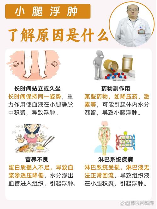 小腿浮肿是什么原因？别不当回事，这可能是身体发出的求救信号！