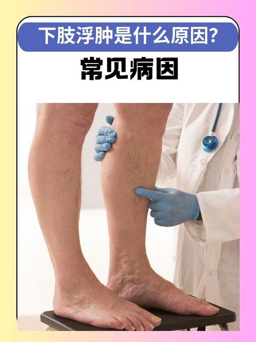 小腿浮肿是什么原因？别不当回事，这可能是身体发出的求救信号！