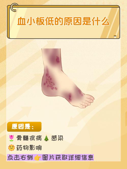 血小板低是什么原因？这5个“元凶”你可能天天在接触！