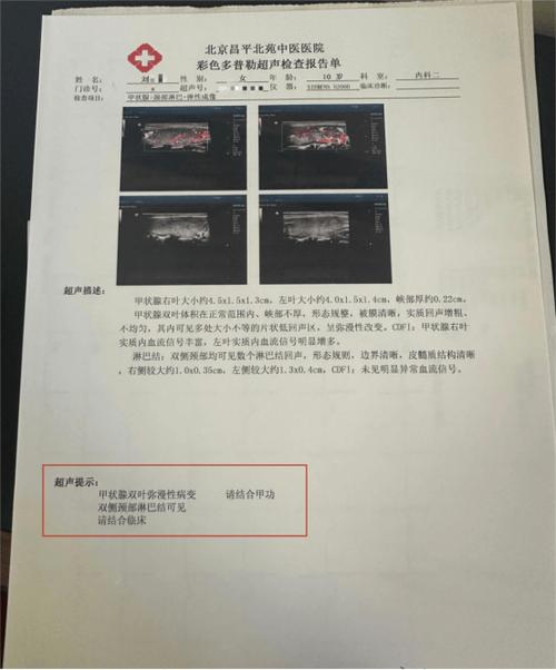甲状腺实质弥漫性病变别慌张！轻松看懂报告单，你的甲状腺有话说