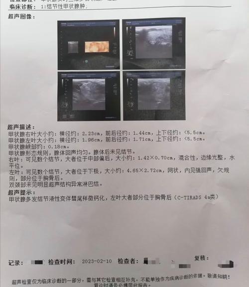 甲状腺实质弥漫性病变别慌张！轻松看懂报告单，你的甲状腺有话说