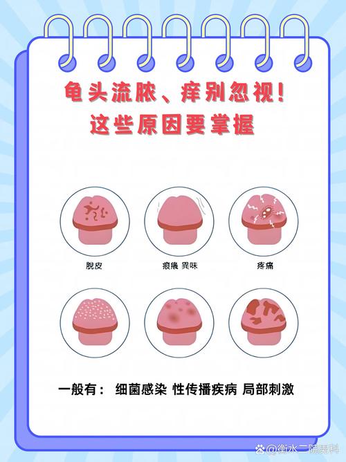 包皮过长龟头炎别轻视！轻松几招教你告别尴尬与不适