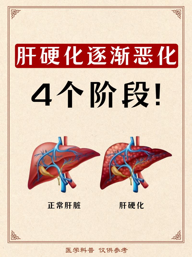 肝弥漫性病变别慌张！看懂这几点，轻松守护你的“小心肝”