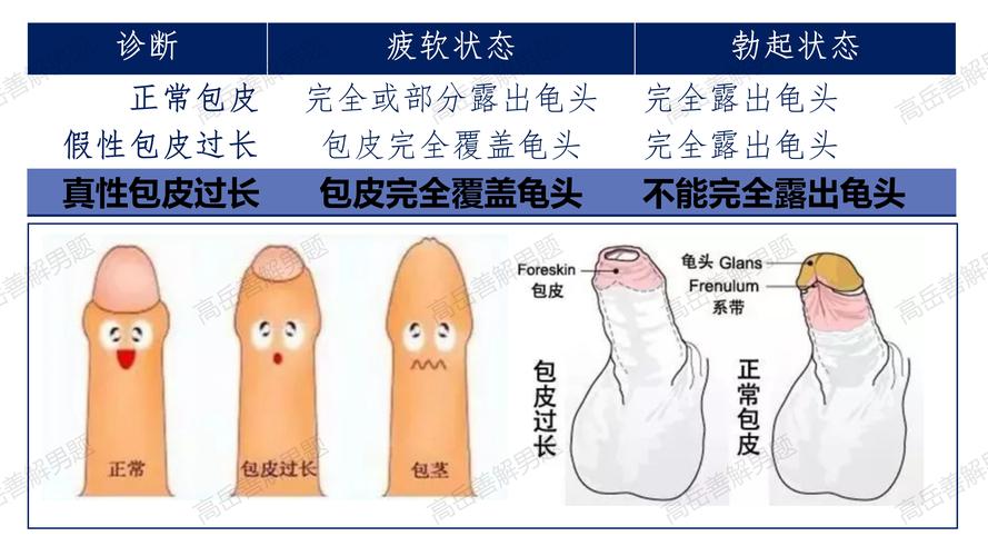 包皮过长手术图片全解析：轻松了解过程，告别手术恐惧！