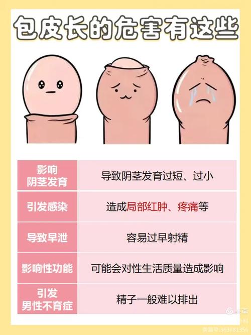 包皮为什么会过长？揭秘男性健康的隐秘真相与轻松应对指南