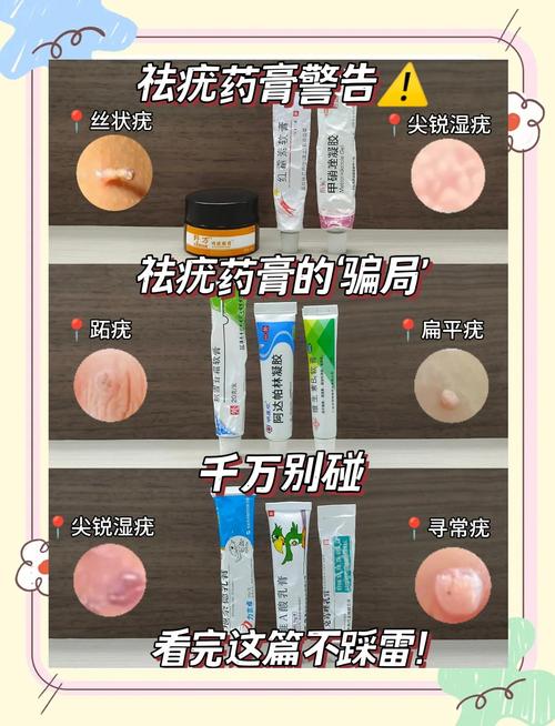 尖锐湿疣药怎么选？专家教你轻松辨别，告别尴尬困扰！