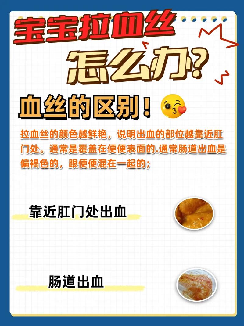 宝宝拉肚子有血丝黏液怎么回事?别慌!教你快速看懂“便便警报”