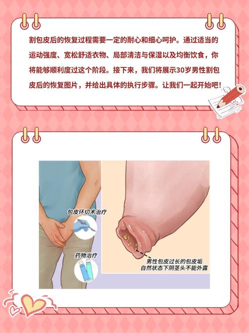 包皮过长怎么处理?别慌!这几种方法让你轻松解决烦恼