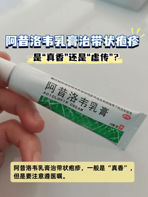 带状疱疹吃什么药？这份超全用药指南帮你快速缓解疼痛！