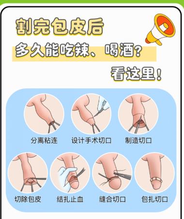 包皮过长治疗别拖延，轻松解决重获健康自信！