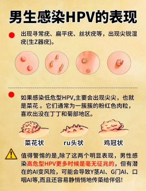 男性HPV感染有什么表现？这8个信号千万别忽视！