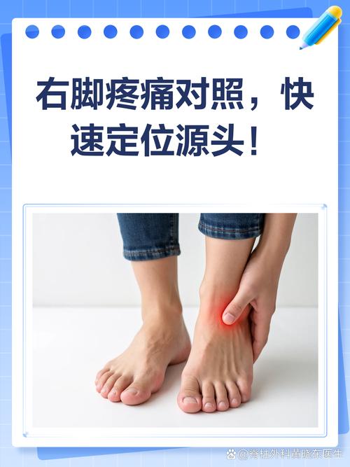 痛风一般脚哪里疼痛？脚趾、脚踝还是脚跟？一文说清疼痛位置与缓解妙招