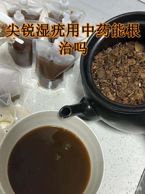 中药治疗尖锐湿疣真的有效吗？过来人分享真实经历，少走弯路！
