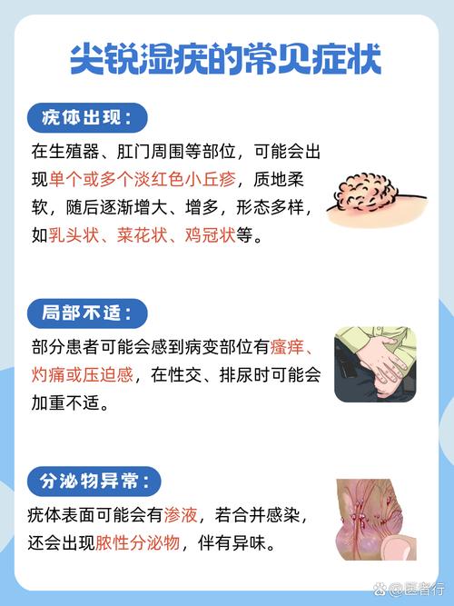 尖锐湿疣可以彻底治愈吗？别慌！专家带你轻松走出困扰