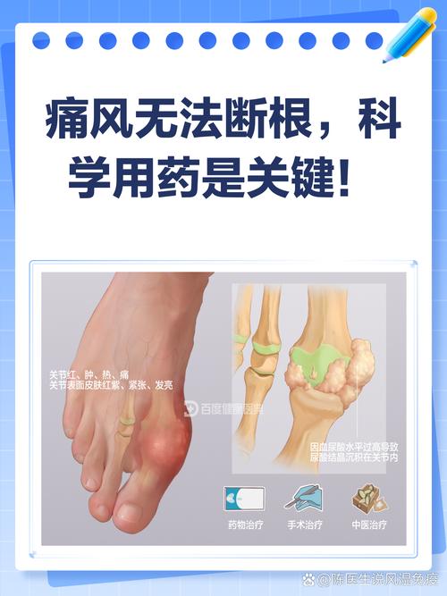 痛风定片怎么吃才有效？轻松掌握正确用法，告别关节疼痛！