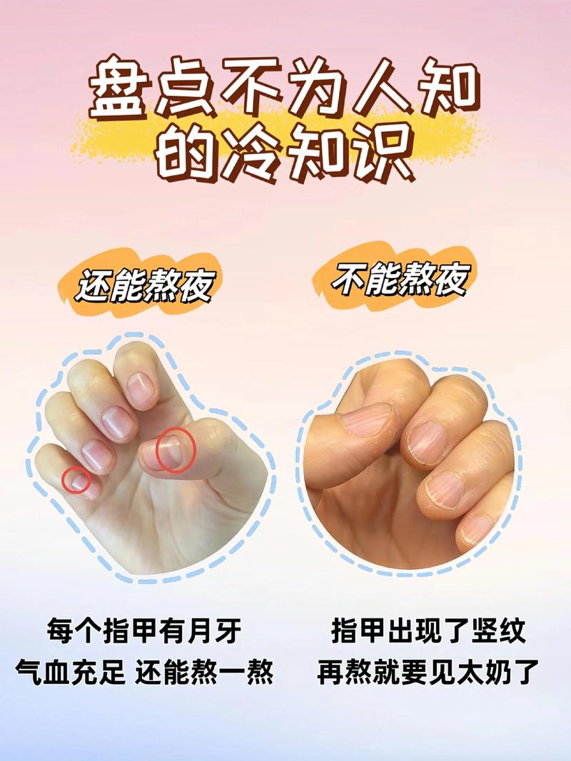 指甲有竖条纹是什么原因？别慌！这几种情况你该知道