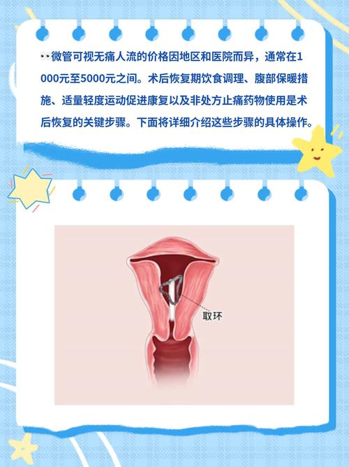 微创人流真的无痛又安全吗？专家揭秘手术全过程与术后恢复要点