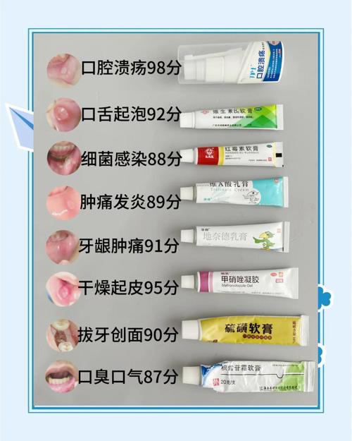 口腔溃疡吃什么药最管用?专家教你快速止痛愈合的小妙招!