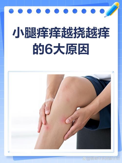 小腿痒痒越挠越痒是什么原因？专家揭秘背后真相，教你轻松止痒！