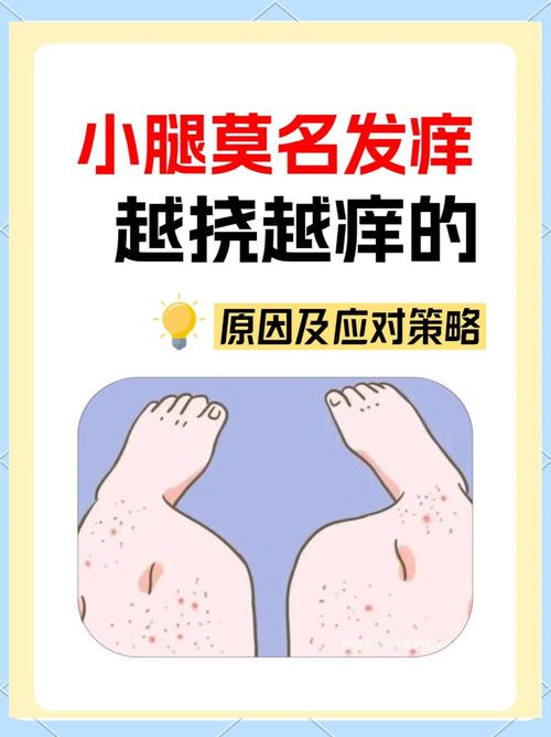 小腿痒痒越挠越痒是什么原因?专家揭秘背后真相,教你轻松止痒!