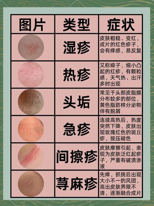 皮肤性病学入门指南：轻松读懂你的皮肤健康信号
