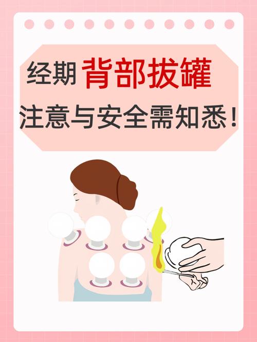 月经期能拔罐吗？不注意这几点小心伤身又加重不适！