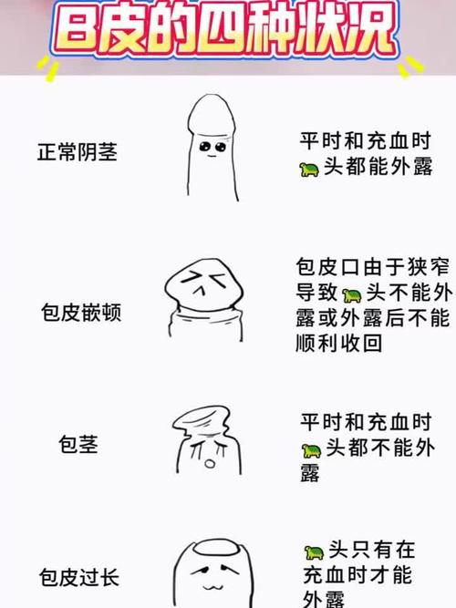 怎样判断包皮过长？3个简单方法在家就能自查，别等发炎了才着急！