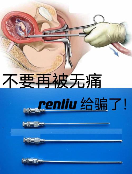 可视无痛人流真的不痛吗？看完这篇你就全明白了！