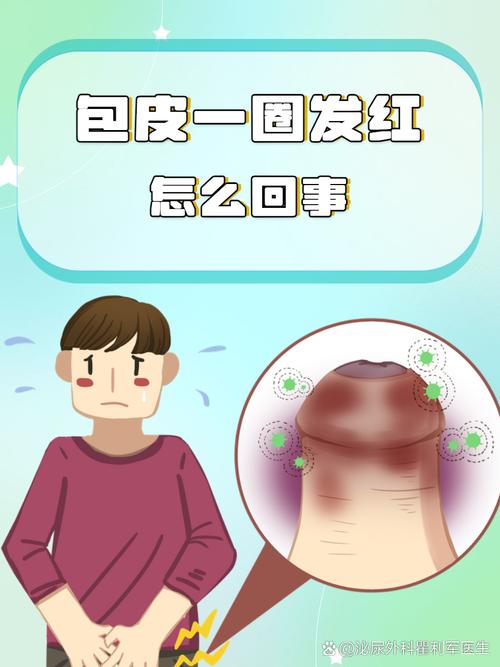 包皮过长有哪些症状？别害羞，这5个信号提醒你该注意了！