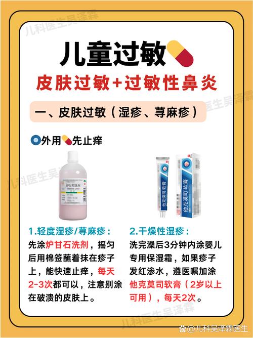 过敏吃什么药?别乱吃!这份超全指南帮你快速缓解不适