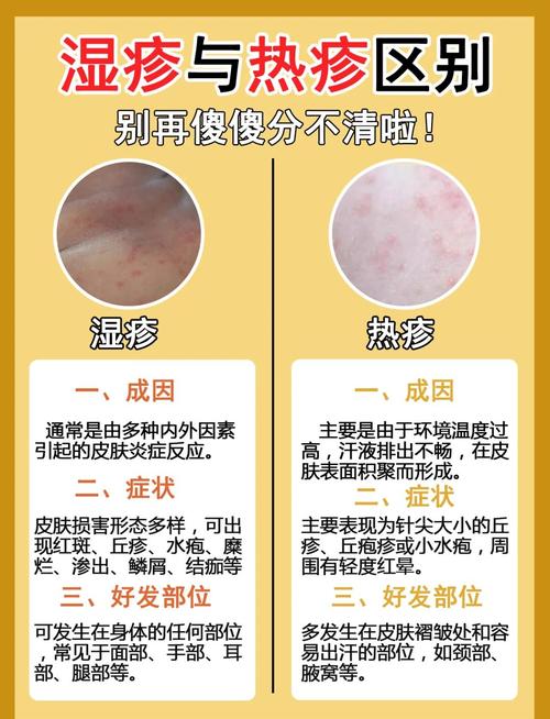 湿疹是什么原因引起的？轻松搞懂皮肤闹脾气的真相！