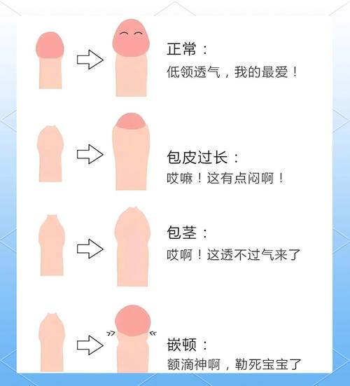 包皮过长对比：你的情况属于哪一种？别让“小问题”拖成大麻烦！
